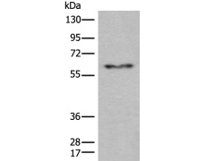 兔抗CES2多克隆抗体