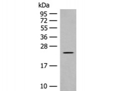 兔抗CLEC3B多克隆抗体