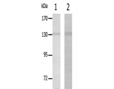 兔抗COL20A1多克隆抗体