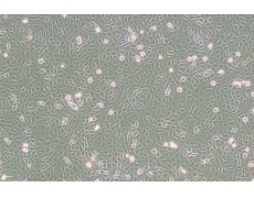 9L/lacZ大鼠胶质肉瘤细胞