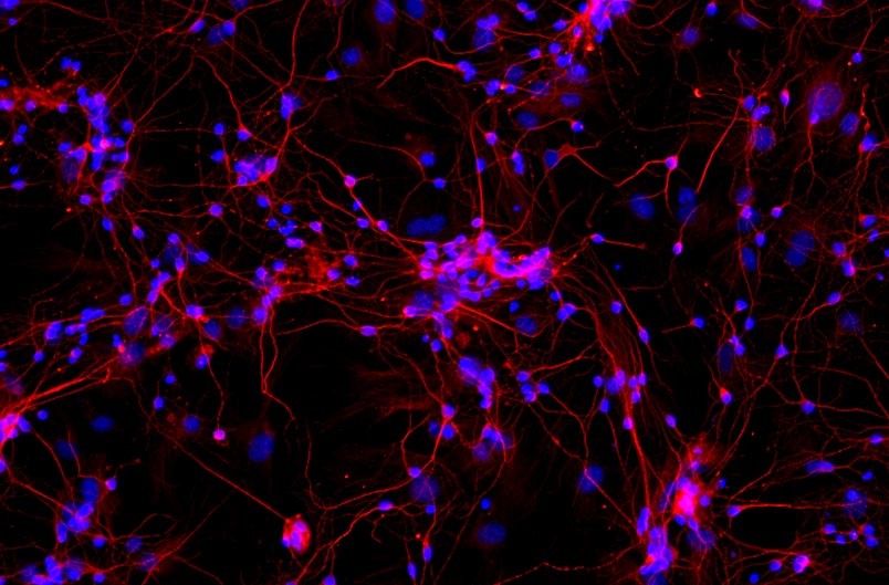 大鼠皮层神经元细胞
