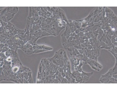 Li-7人肝癌细胞