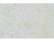 OKT 11小鼠杂交瘤细胞(抗CD2)