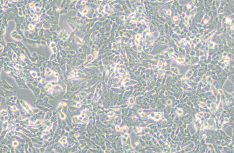NCI-H295R人肾上腺皮质腺癌细胞