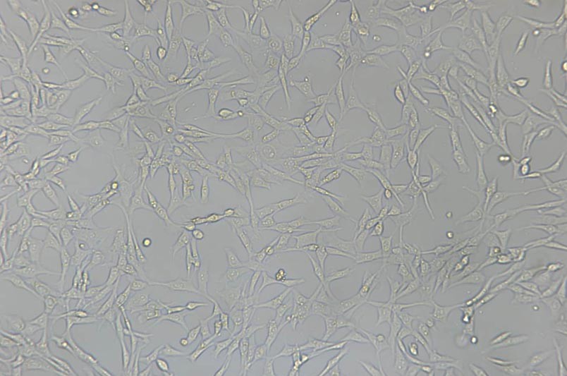PA317小鼠成纤维细胞