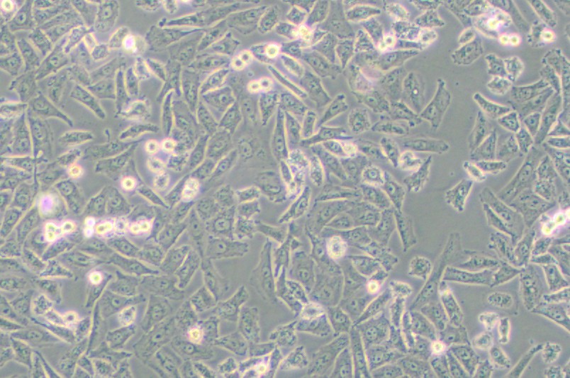 NCI-H1703人肺鳞癌细胞