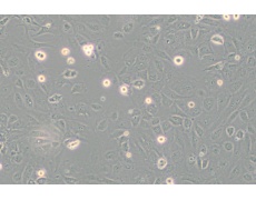 SVEC4-10小鼠淋巴结内皮细胞