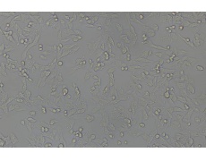 Y-1小鼠肾上腺皮质瘤细胞