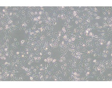 B16-F0小鼠黑色素瘤细胞