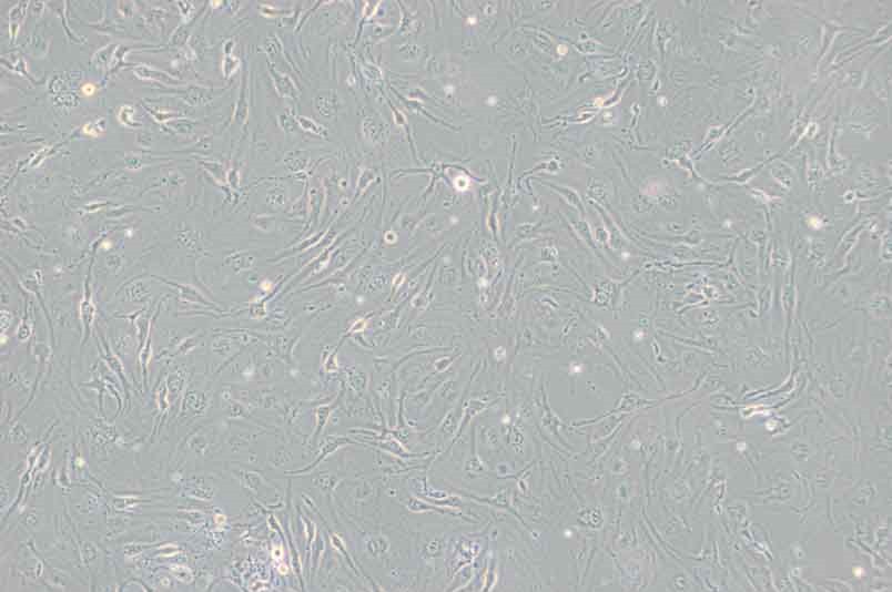 bEnd.3小鼠脑微血管内皮细胞