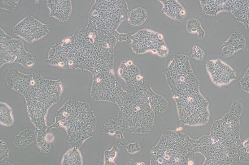 RT4人膀胱移行细胞乳头瘤细胞