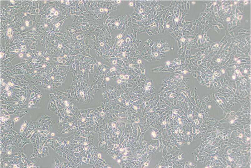 SK-N-AS人神经母细胞瘤细胞
