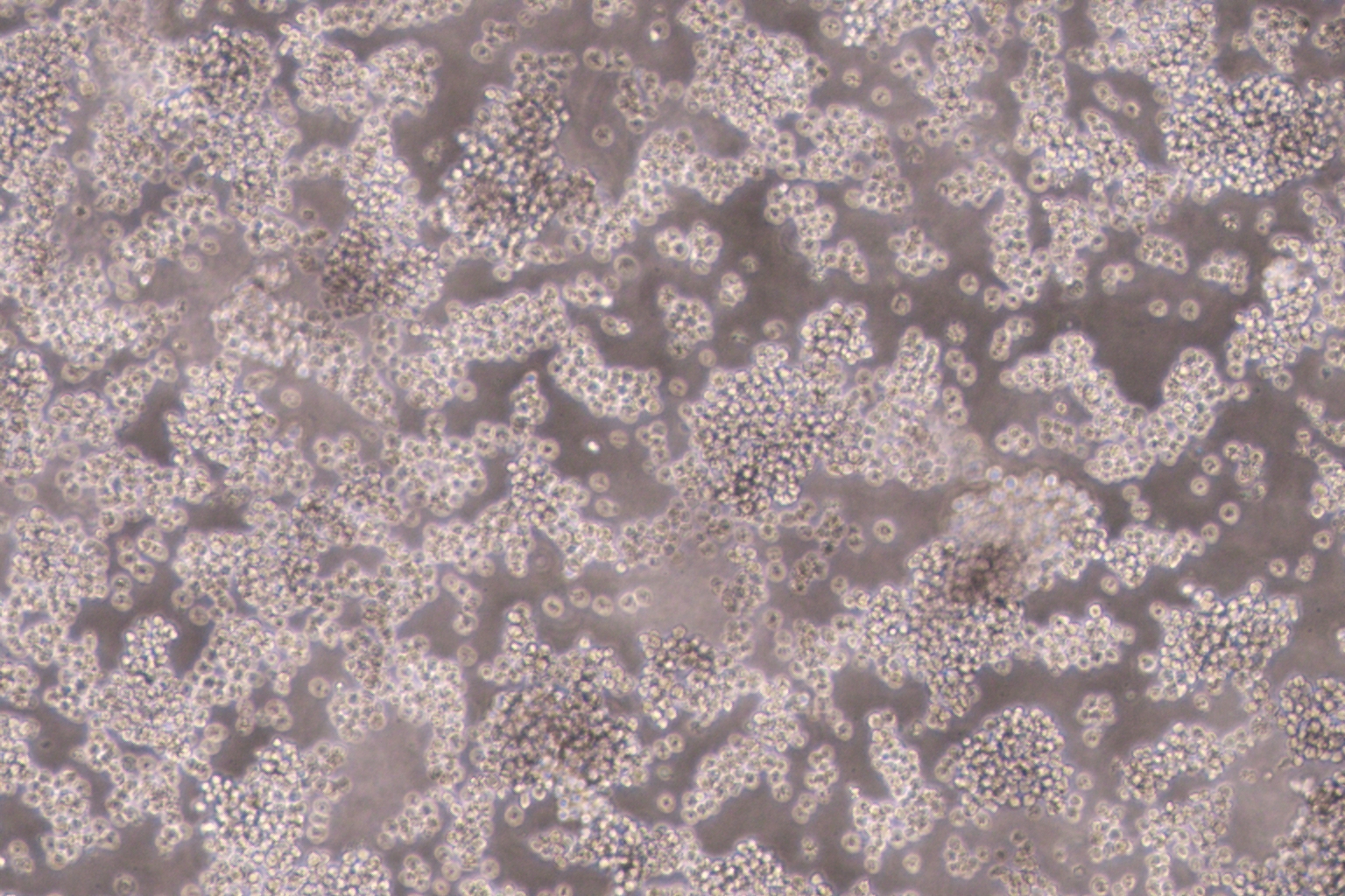 NB4人急性早幼粒细胞白血病细胞