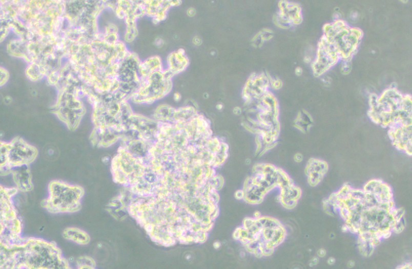 NCI-H209[H209]人小细胞肺癌细胞