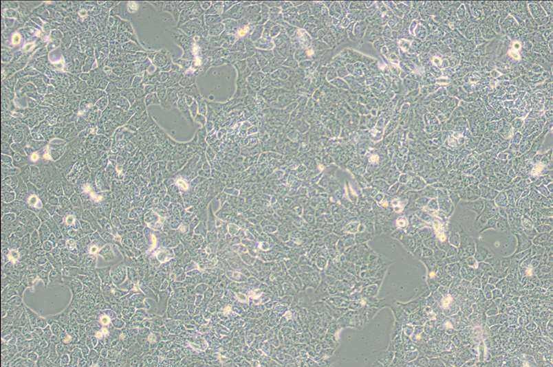 NCI-H2228[H2228; H-2228]人肺癌细胞