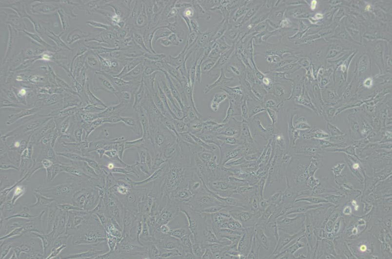 SW1353人软骨肉瘤细胞(L15)