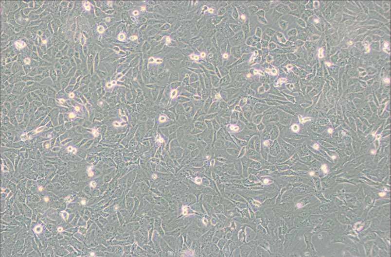 SW872人脂肪肉瘤细胞(L15)