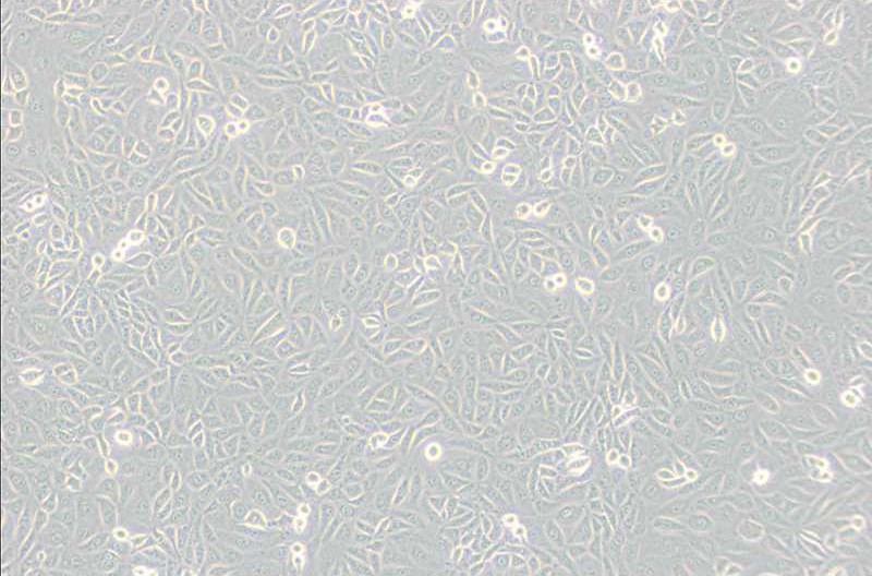 TPC-1人甲状腺癌细胞