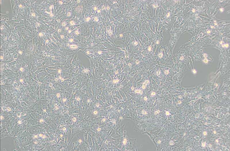 TTA1人甲状腺癌细胞