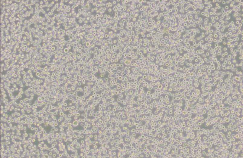 U266 [U266B1]人多发性骨髓瘤细胞
