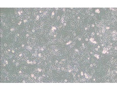 UM-UC-3人膀胱移行细胞癌
