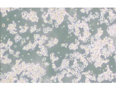 WERI-Rb-1人视网膜神经胶质瘤细胞