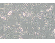 Caki-2人乳头状肾细胞癌细胞