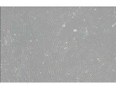 CCD-1095Sk人乳腺浸润性导管癌旁皮肤细胞