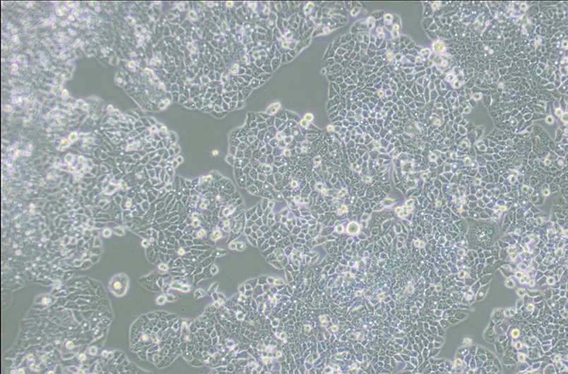 CX-1人结肠癌细胞