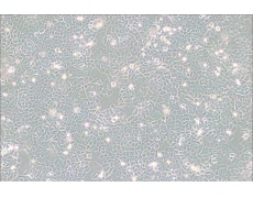 Hela-229人宫颈癌细胞