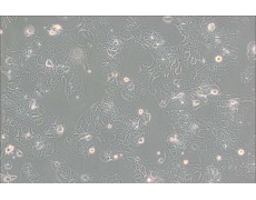 HT-1376人膀胱癌细胞