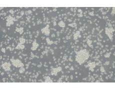 HuT-78人T淋巴细胞白血病细胞