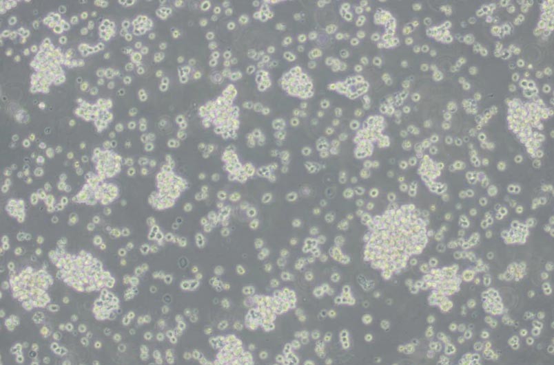 HuT-78人T淋巴细胞白血病细胞