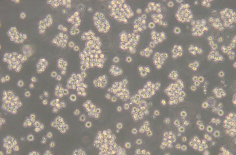 Jurkat, Clone E6-1人T淋巴细胞白血病细胞