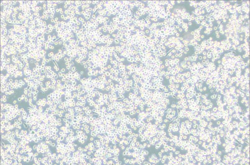 M-07e人巨细胞白血病细胞