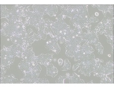 MDA-MB-361人乳腺癌细胞(DMEM)