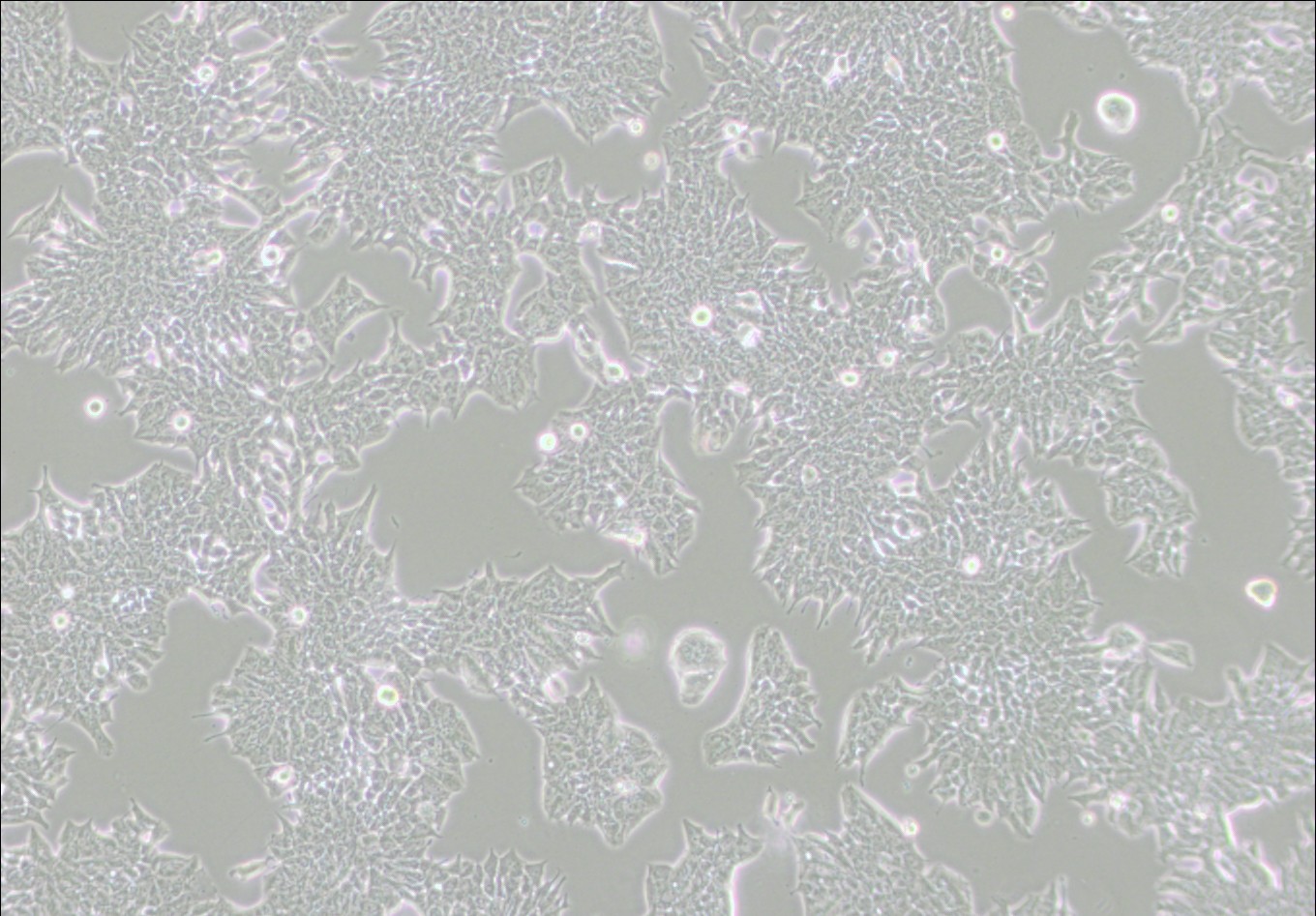 MDA-MB-361人乳腺癌细胞(DMEM)