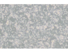 MDA-MB-436人乳腺癌细胞(DMEM)