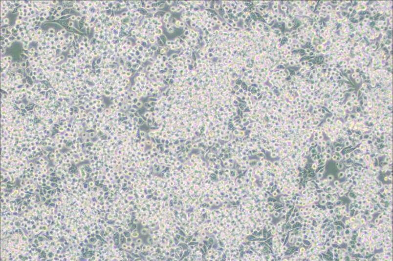 MIA-PaCa-2人胰腺癌细胞