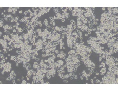 MDA-MB-453人乳腺癌细胞(L15)