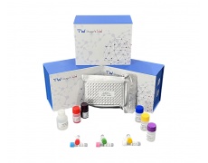 人磷酸化肌球蛋白轻链（PMLC）试剂盒