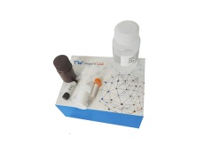 唾液酸(SA)含量(神经氨酸苷酶法)检测试剂盒微板法/48样