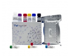 兔甲状腺球蛋白(TG)试剂盒